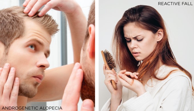Androgenetic Alopecia (or baldness) Reactive (or seasonal) Hair Loss 