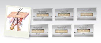 Crescina hair follicular islands