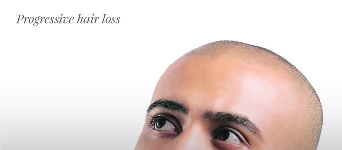 Progressive hair loss