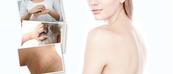 3 types of dermatitis: how to treat them