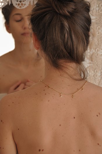 Skin cancer | prevention and self-examination
