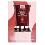 hair system 3gf hair loss  14uni (expiring 04/2019)