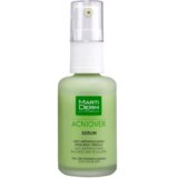 acniover prevent regulating anti-blemish serum 30ml