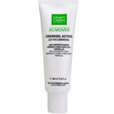 acniover control creme-gel activo peles oleosas e acneicas 40ml