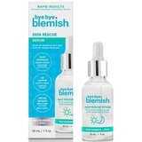 Bye Bye Blemish Skin Rescue Serum 30 mL