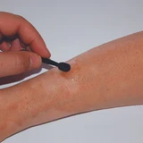 ACM Laboratoire Dermatologique