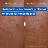Mixa