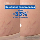 Mixa