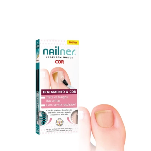 Nailner