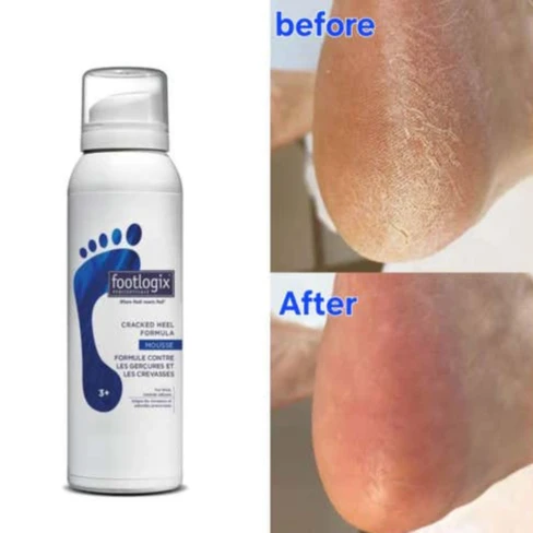 Footlogix