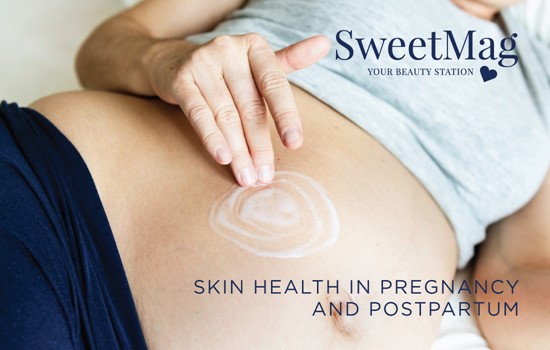 SWEETMAG | SKIN HEALTH IN PREGNANCY AND POSTPARTUM