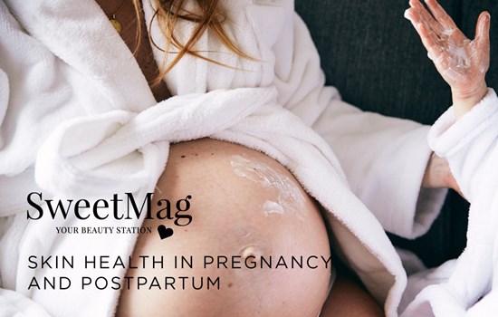 SWEETMAG | SKIN HEALTH IN PREGNANCY AND POSTPARTUM